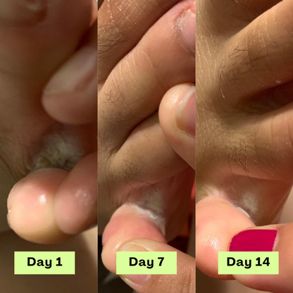 The Athlete’s Foot Recovery Bundle