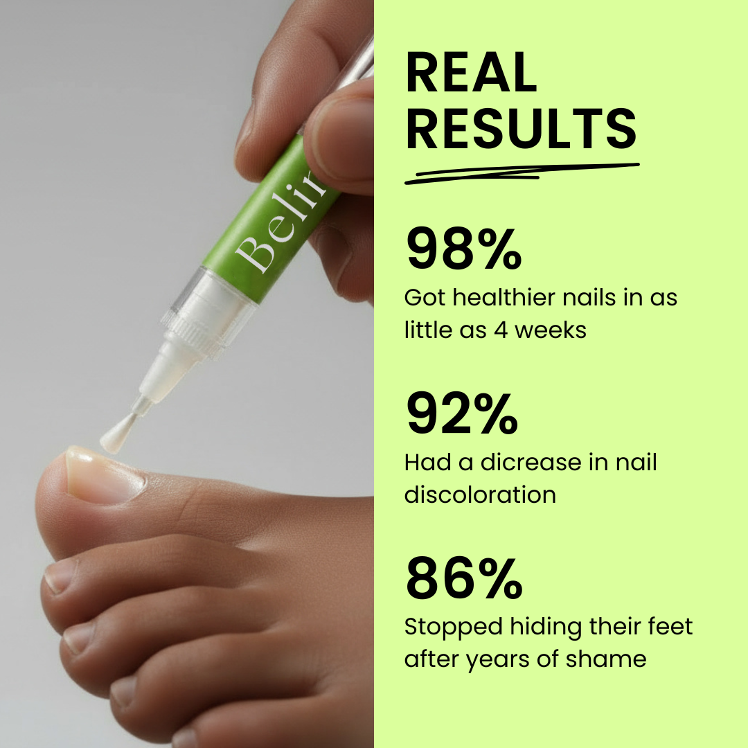 Beline Nail Care Pen - 25% Undecylenic Acid